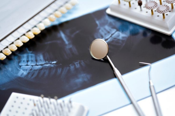Implantation and crowns - 5